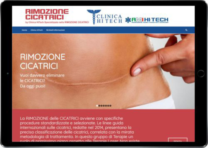 clinicahitech_siti_ipad_060917_cicatrici_big